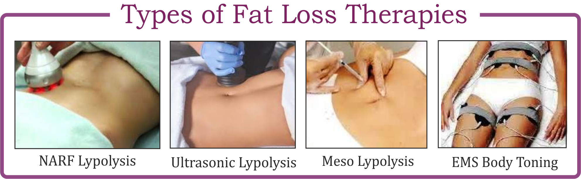 PG Diploma in Obesity Management